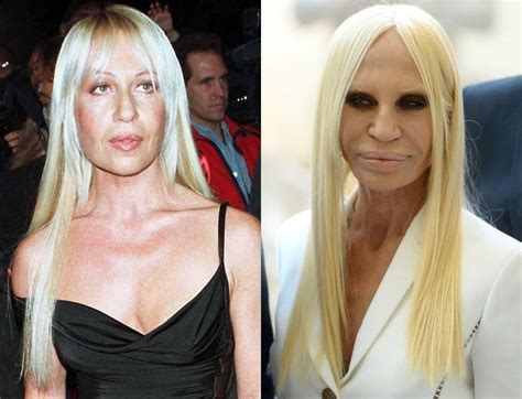 donatella versace before after|donatella versace plastic surgery 2022.